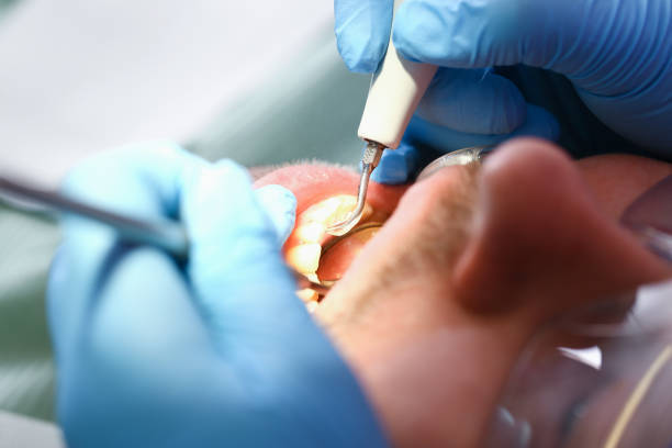 Best Tooth Pain Emergency Relief  in Flagtown, NJ