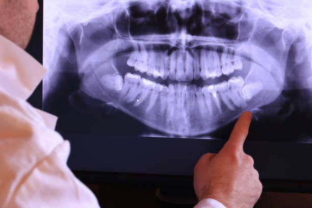 Tooth Infection Emergency Dentist in NJ